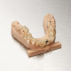 Formlabs Resina Dental SG (Surgical Guide) | Form 3B Series